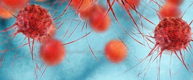 Cancer cells stock image